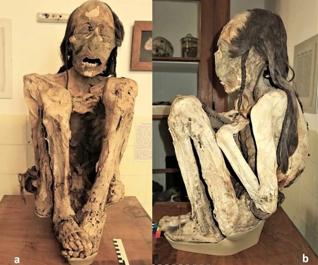 The Marburg mummy was believed to have died in one of two ways. Credit: A-M Begerock, R Loynes, OK Peschel, J Verano, R Bianucci, I Martinez Armijo, M González, AG Nerlich