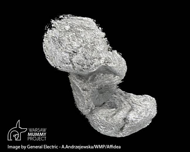 Mummified Foetus Discovered (Warsaw Mummy Project)