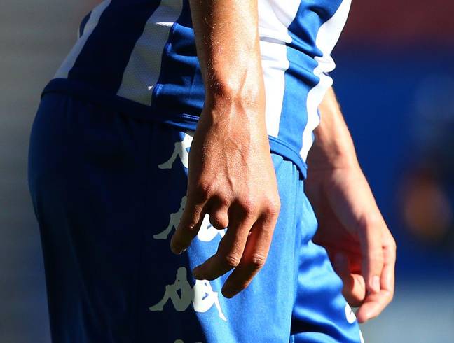 Burn's missing finger during his Wigan days. Image: PA Images