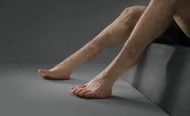 Bu iğneler ve toynak benzeri ayaklar, Graham'a bir yaya çarpışmasında yardımcı olabilir.  Kredi: Ulaştırma Kaza Komisyonu