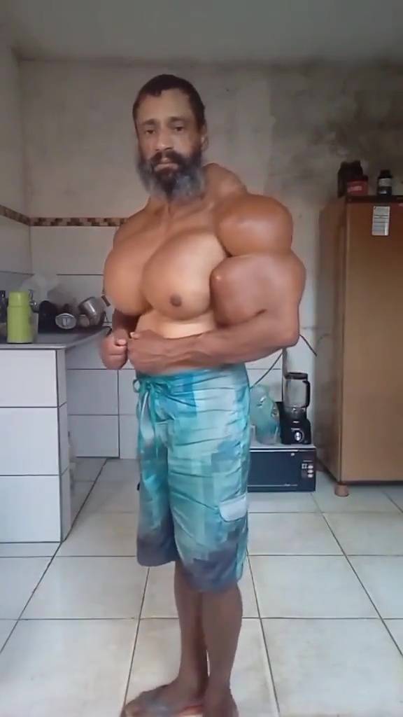 'Brazilian Hulk' Bodybuilder Who Injected His Muscles With Oil Dies Aged 55