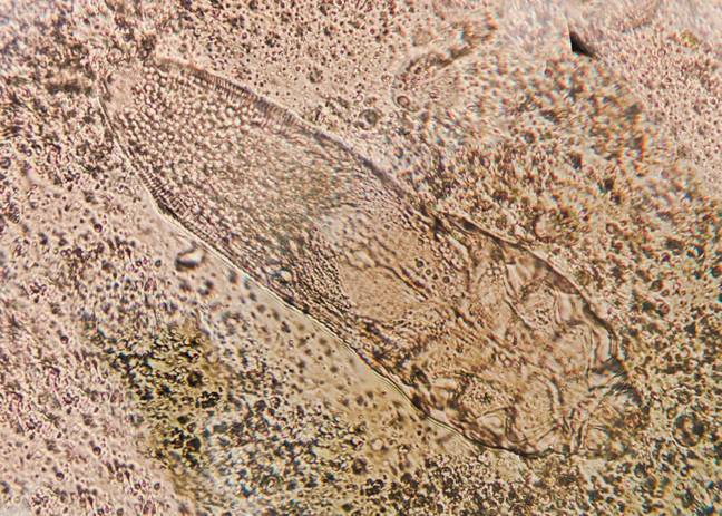 TrivDaily - People creeped out after finding out about creatures which live and have sex on your face 41 Researcher's new discovery has people creeped out. Credit: Mohammed Al ali/Alamy Stock Photo