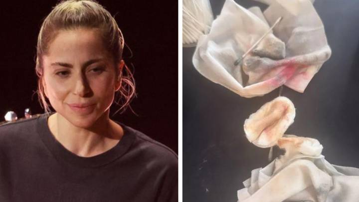Lady Gaga's glam artist shares 'aftermath' of Oscars make-up removal