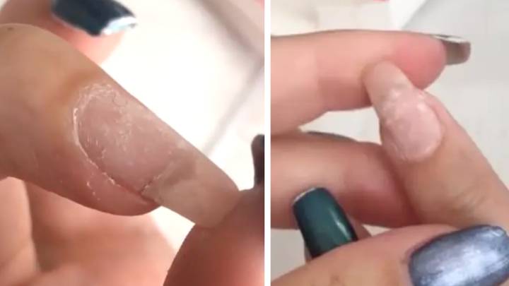 Woman Claims You Can Fix Broken Nails With A Teabag