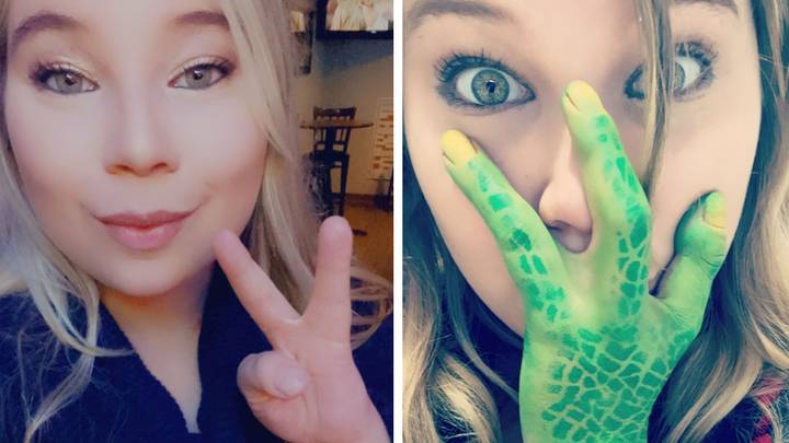 Woman who was bullied for having three fingers says she wouldn't change anything