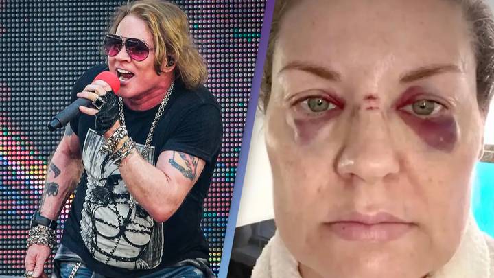 Axl Rose responds after fan 'hit in nose' by microphone at Guns N Roses concert