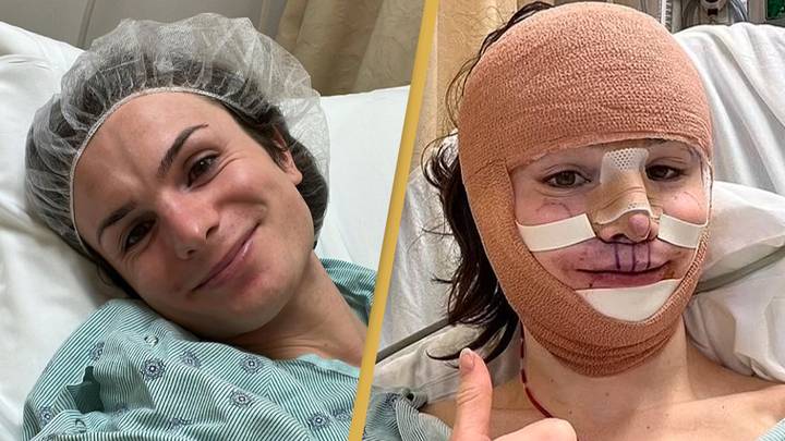 TikTok influencer Dylan Mulvaney shows off results of facial feminization surgery