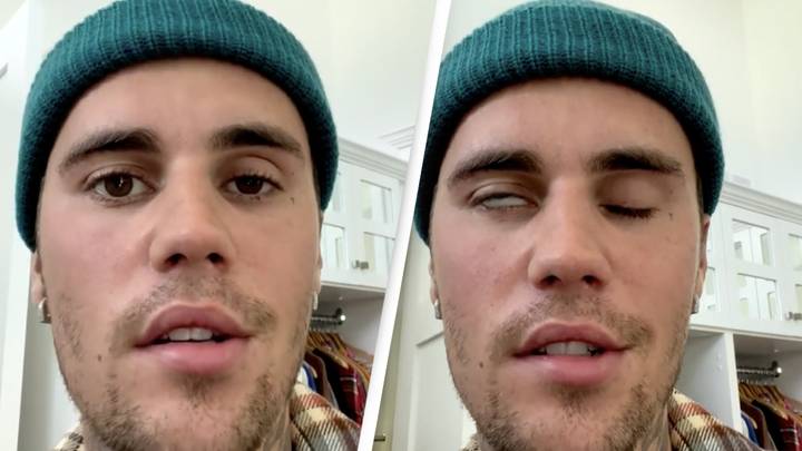 Justin Bieber Updates Fans On His Health After Ramsay Hunt Syndrome Shock