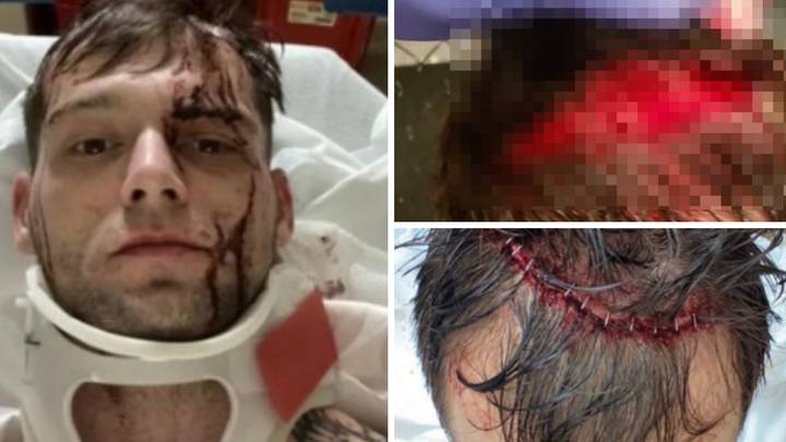 MMA Fighter Suffers HORRIFIC Head Injury Caused By Exposed Cage Bracket