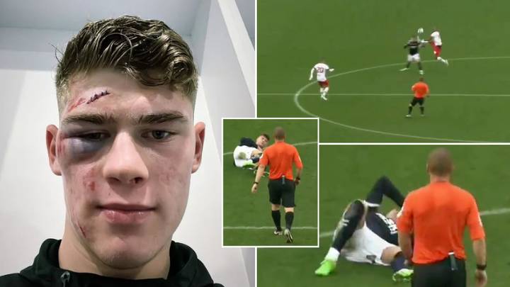 Millwall's Charlie Cresswell played full 90 minutes after being kicked in the head, kept clean sheet
