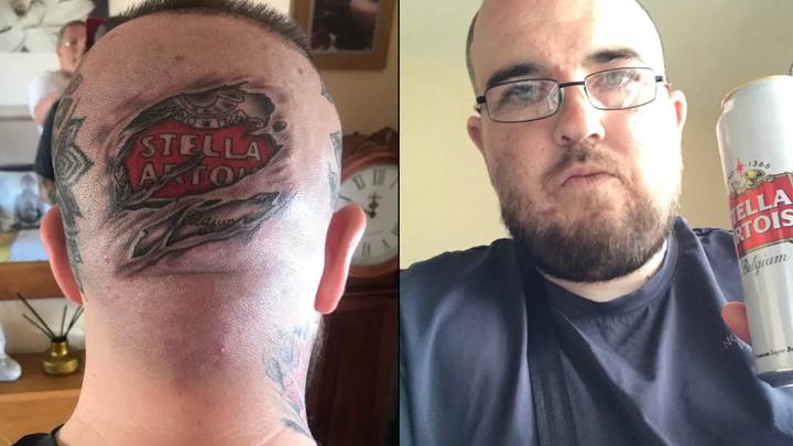 Uk News Man Gets Full Size Stella Tattoo On The Back Of His Head To Dedicate His Love To Drink Uk News Man Gets Full Size Stella Tattoo On The Back Of His Head To Dedicate His Love To Drink