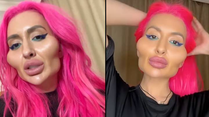 Model With 'World's Biggest Cheeks' Has New Surgery To Look Even More Extreme