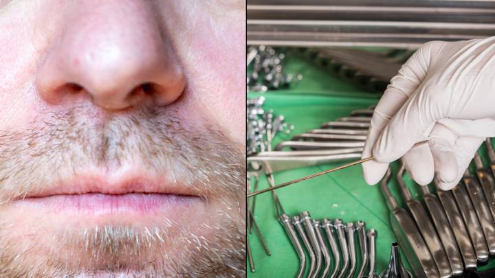 Man Who Was Having Trouble Breathing Had Tooth Growing In Nose