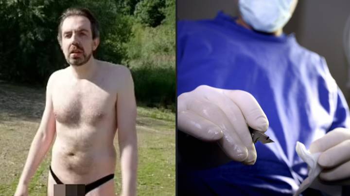 Man with 10.5-inch penis says he's often thought about getting reduction surgery