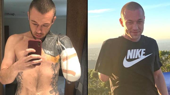 Man wakes up to find he's lost his arm after bicep curl at gym goes horribly wrong