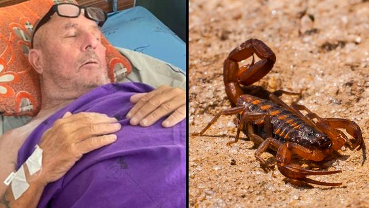 Brit dad could lose leg after being stung by a scorpion