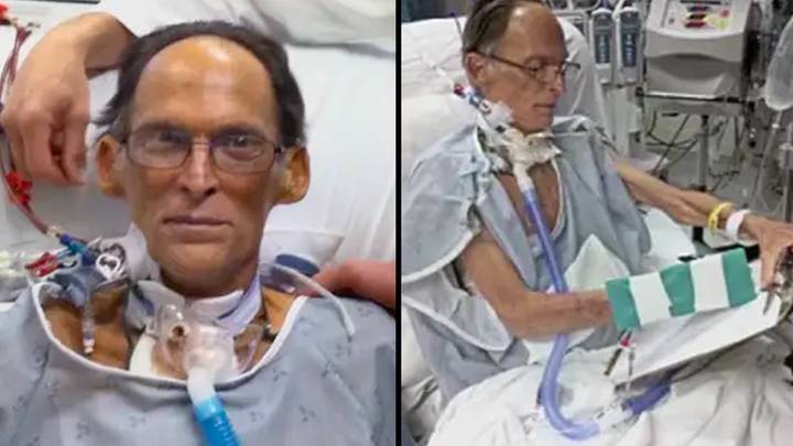 World's first heartless human was able to live without a pulse