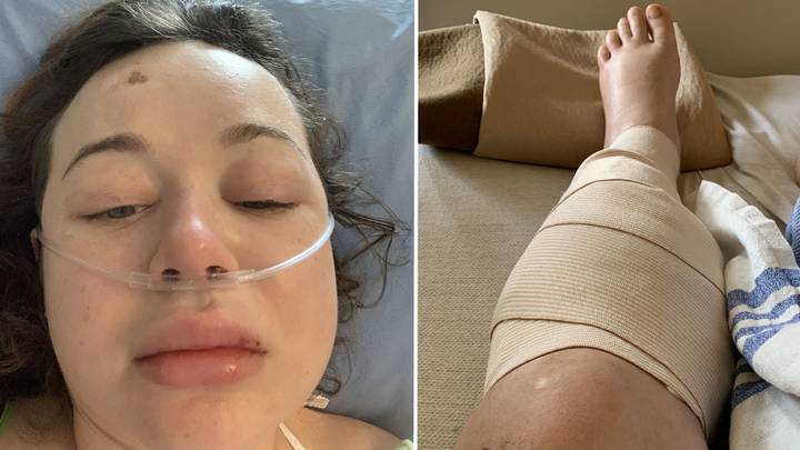 Mum almost needed her legs amputated after waking up from girls' night out