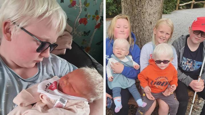 Mum of three children with albinism wishes people would stop making 'rude' and 'nasty' comments