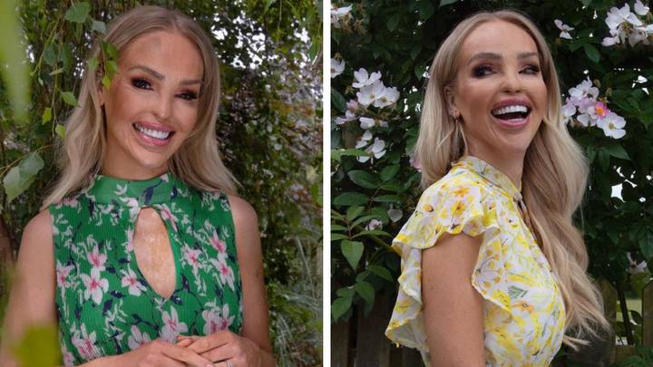 Katie Piper praised for sharing inspirational post as acid attacker goes on the run