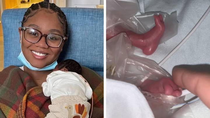 Mum who was told 1lb 11oz baby 'would not survive' after arriving three months early says he's thriving