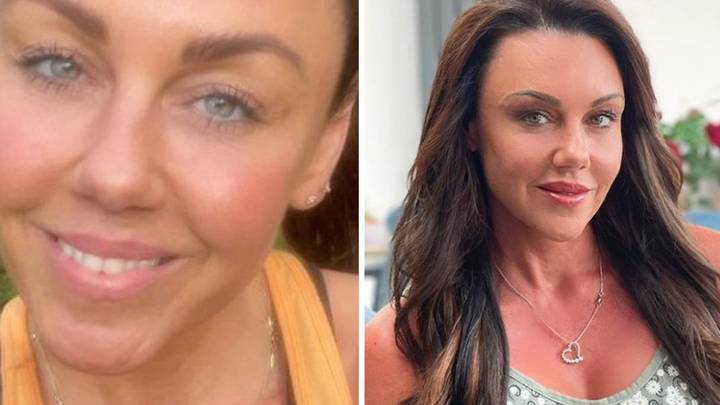 Michelle Heaton Shares Reality Of Addiction In Before And After Snap