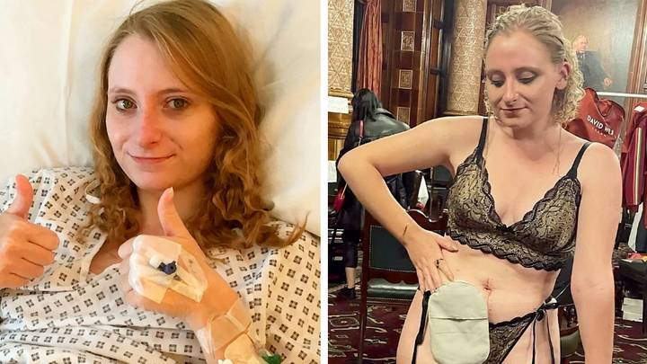 Woman who was bedbound for five years says stoma bag gave her new lease of life