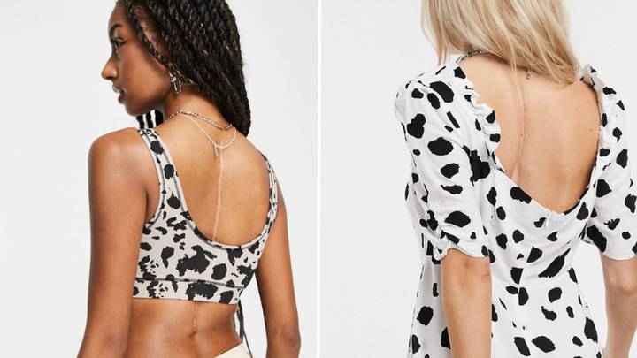 ASOS praised for showing model with scoliosis