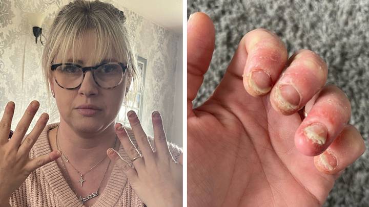 Mum's warning as she can barely move her hands after years of getting her nails done