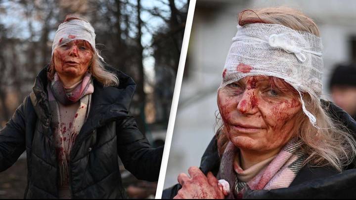 Ukraine: Teacher Covered In Blood After Surviving Missile Attack Thanks ‘Guardian Angel’