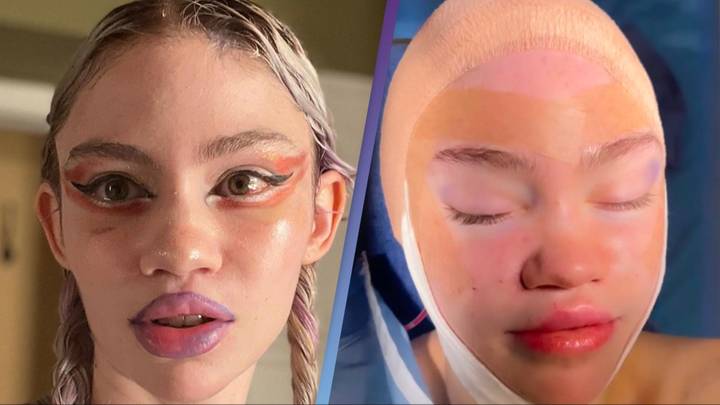 Grimes Posts Selfie For The First Time After Surgery And Fans Seem grimes-posts-selfie-for-the-first-time-after-surgery-and-fans-seem