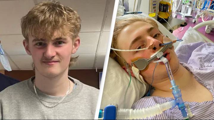Teen complaining of headaches had to have part of his skull removed and stitched to his back