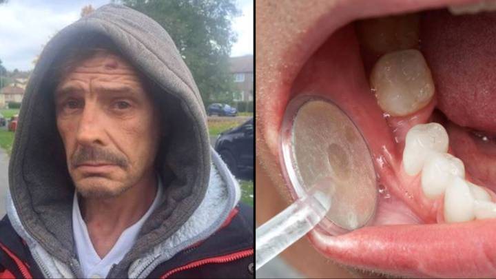 Man pulls own teeth out after being unable to book dentist appointment
