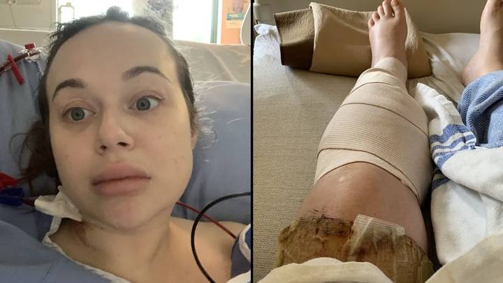 Woman almost needed legs amputated after waking up from drinking 'a lot' of vodka on night out
