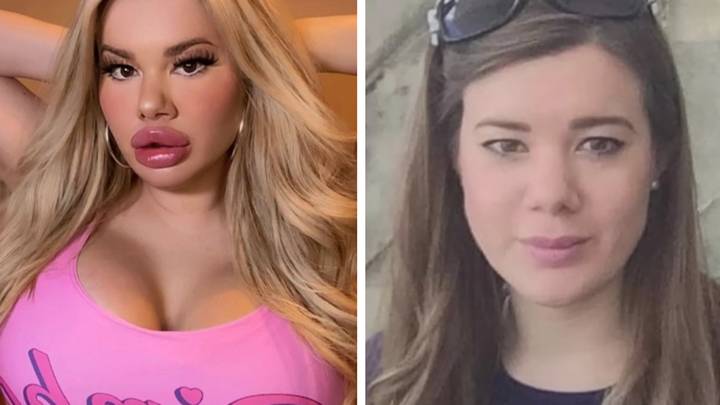 Woman says family abandoned her after spending over £10,000 to look like a 'bimbo doll'