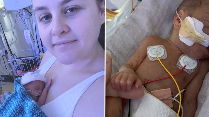 ‘Miracle’ twins born at 25 weeks had to be wrapped in plastic bags to keep them alive