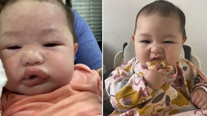 Mum's Stark Warning After Baby 'Almost Died' After Eating Peanut Butter