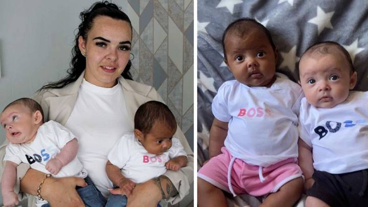 Mum gives birth to million-to-one twins with completely different skin colours