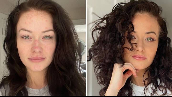 Jess Impiazzi thought she was dying before being diagnosed with incurable condition