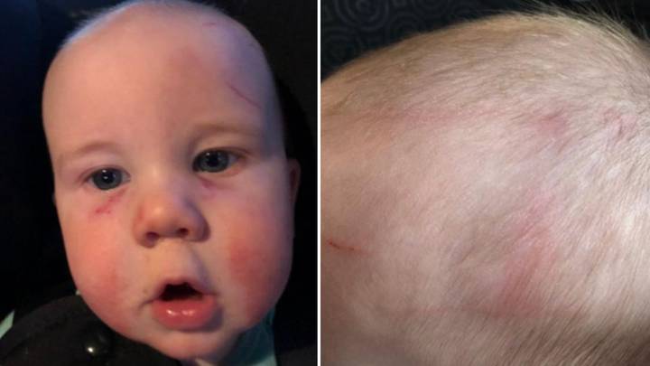 Mum sues nursery after claiming four-year-old boy attacked her baby
