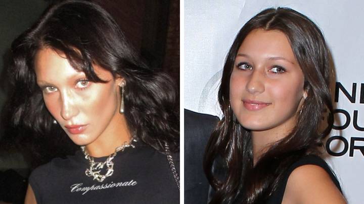 Bella Hadid admits she regrets getting a nose job when she was just 14 years old