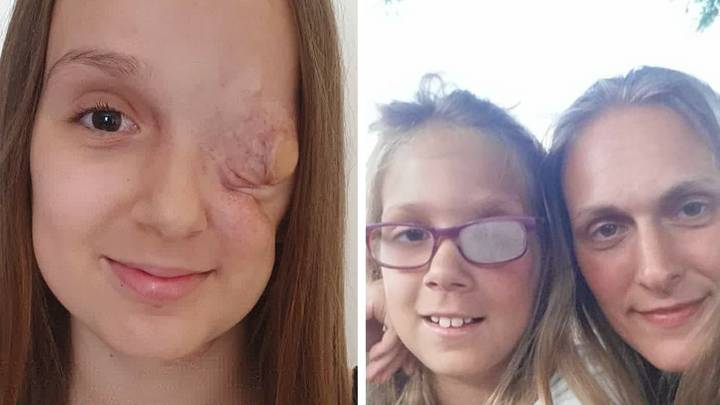 Girl dies from rare cancer despite getting all clear after having eye socket removed