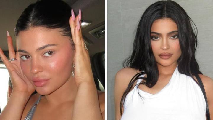 Kylie Jenner denies getting ‘so much surgery on her face’