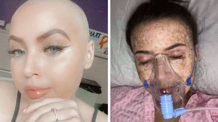 Woman who was told by GP she had tonsillitis correctly diagnosed herself with leukaemia using Google