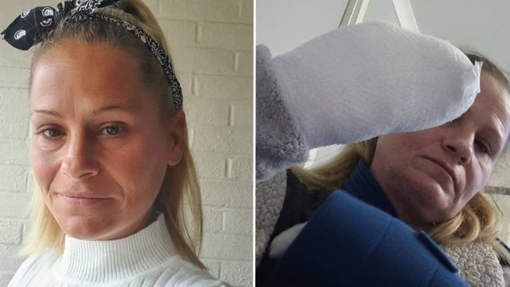 Mum ‘lucky to be alive’ after vape battery exploded in coat pocket and ‘burst into flames’