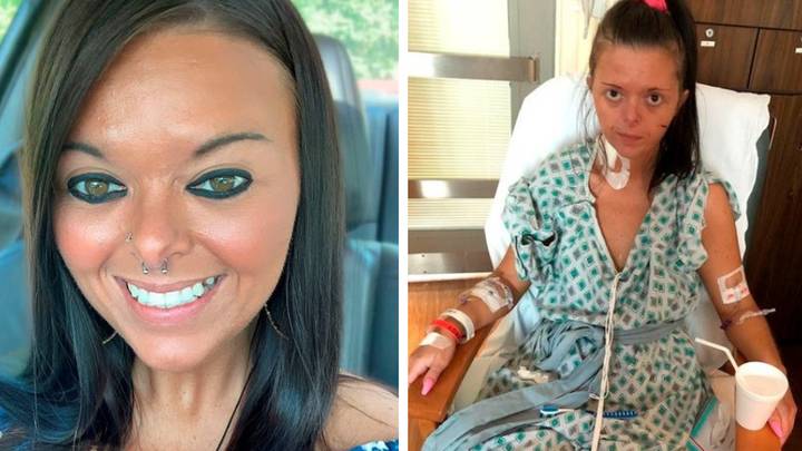 Woman addicted to vaping left on life support with deadly lung condition