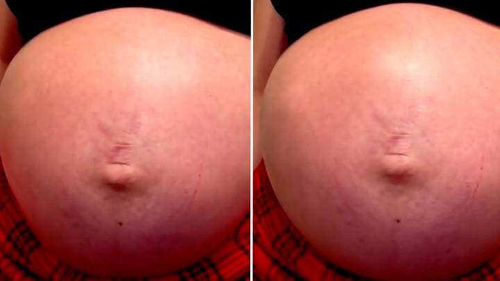 Mum shares incredible video of baby standing up inside her stomach