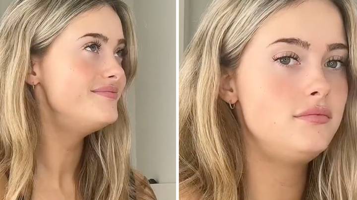 Woman shows how ‘mewing’ can completely change your side profile