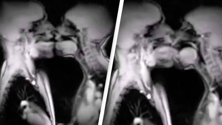 People disturbed by MRI of couple kissing
