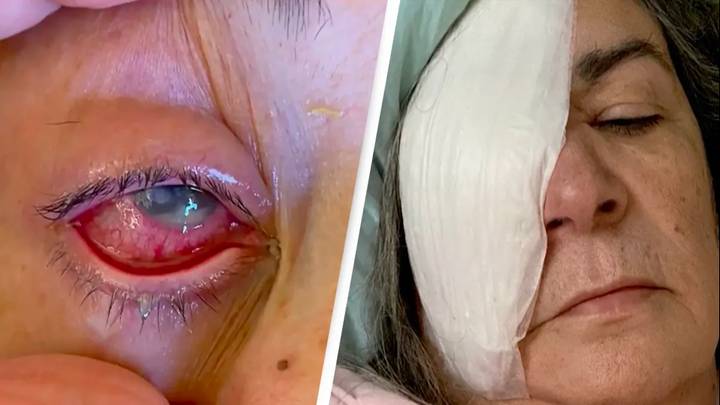 Eyedrops warning issued after one person dies and others have eyes removed